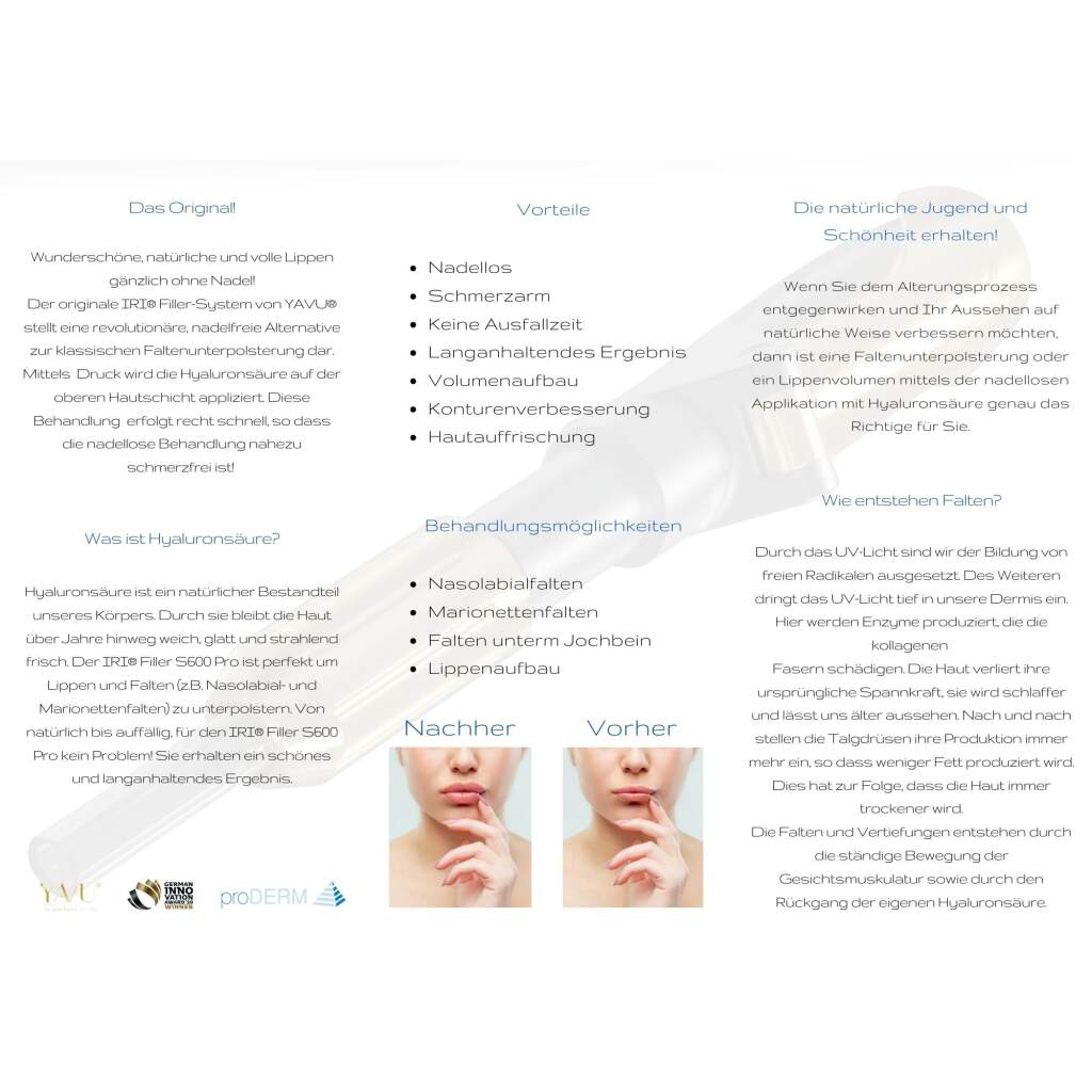 IRI® Filler-System Flyer (versch. Farben - 25 Stk.)