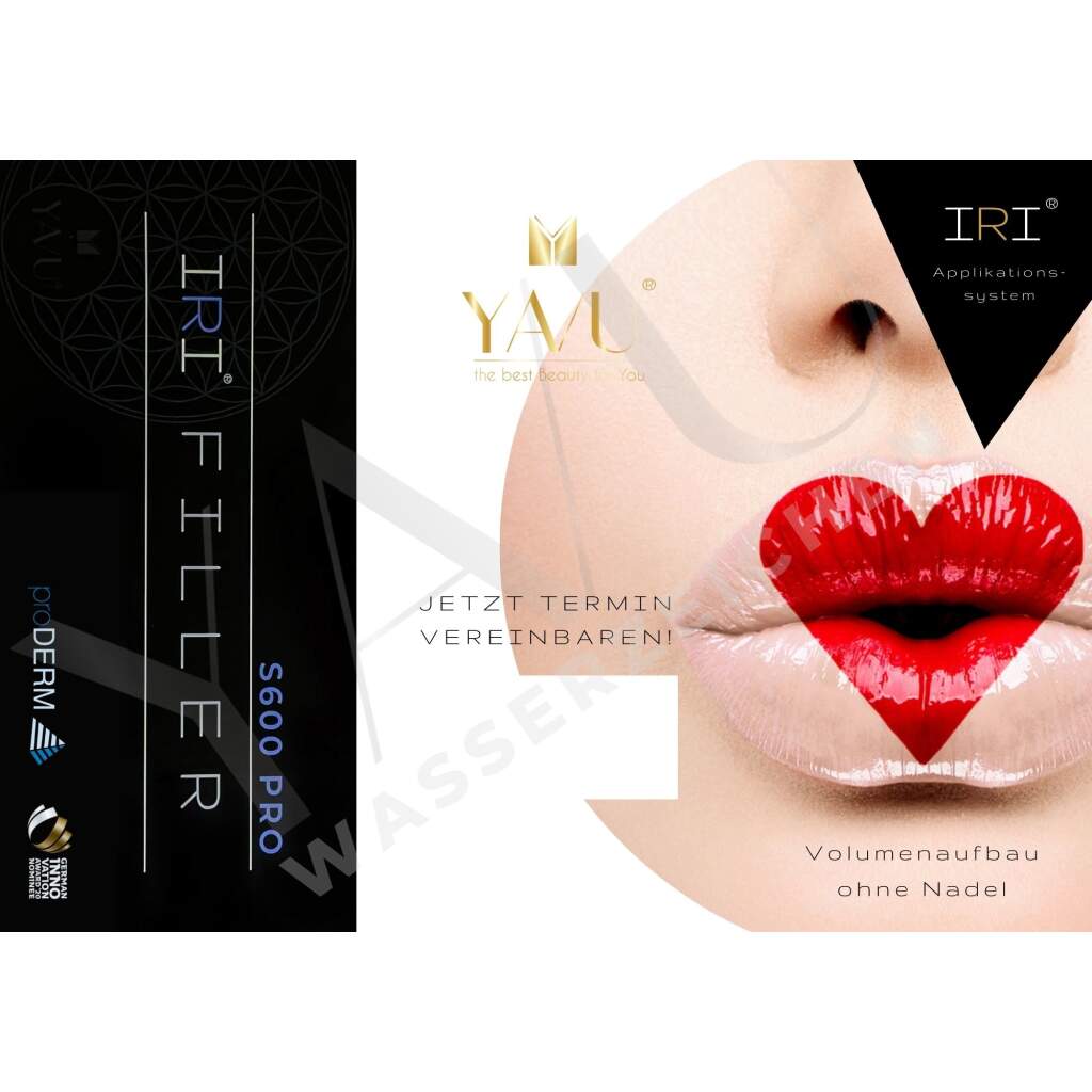 IRI® Filler-System Flyer (versch. Farben - 25 Stk.)