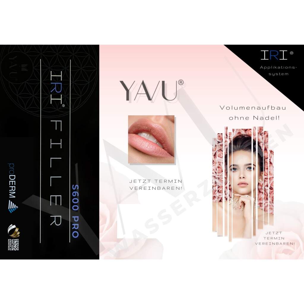 IRI® Filler-System Flyer (versch. Farben - 25 Stk.)